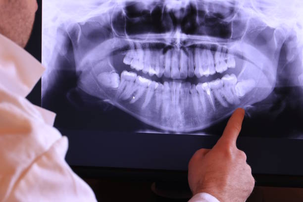 Best Tooth Pain Emergency Relief  in Vails Gate, NY