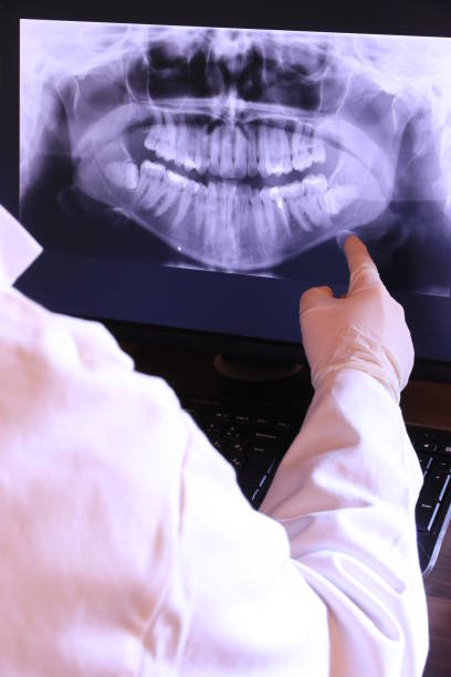 Best Chipped Tooth Repair Near Me  in Vails Gate, NY